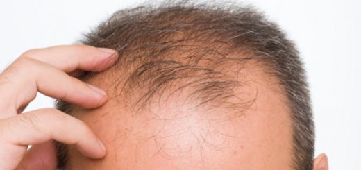Hair Loss
