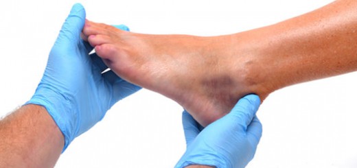 Plantar Fasciitis